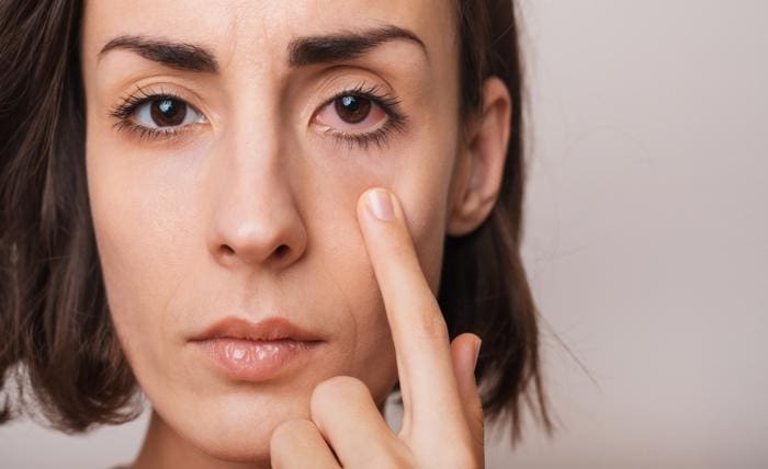 How Pest Control Protects Health and Property Effectively Keeping your eyes healthy